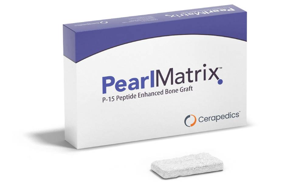 PearlMatrix P-15 Peptide Enhanced Bone Graft box